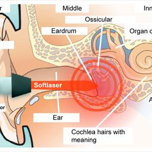  Cheap And Effective Methods To Get Rid Of Tinnitus Symptoms For Good
