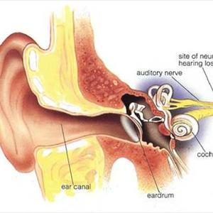 Acute Tinnitus Diagnostic - Mastering Your Life And Tinnitus