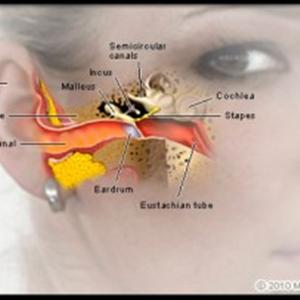Lipoflavonoids For Tinnitus - Remedies For Tinnitus: Learn How You Can Salvage Your Hearing!