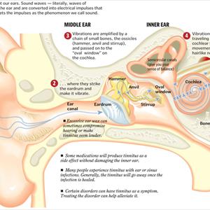 Tinnitus Analysis - What Causes Tinnitus Adult Symptoms?  Read Today