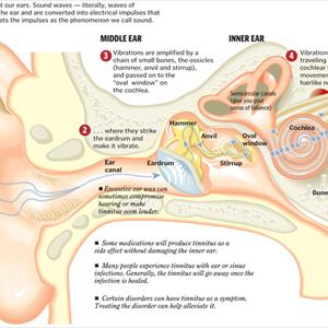  What Causes Tinnitus Adult Symptoms?  Read Today